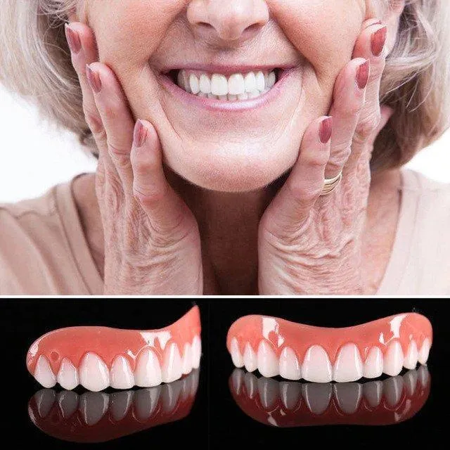Great Smile Veneer (Upper & Lower)