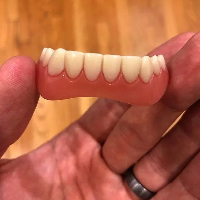 Great Smile Veneer (Upper & Lower)